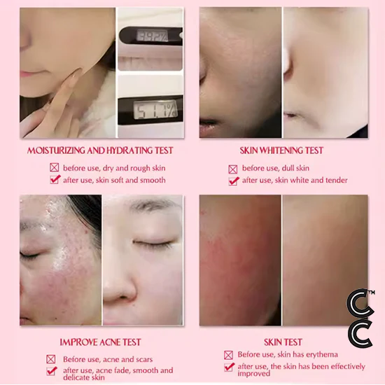 Anti Aging Peptides | Snail Essence Wrinkle Serum (3 vials per order)Skin Care Moisturising Repair Cream Acne Serum Regular
