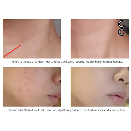 Anti Aging Peptides | Hyaluronic acid Serum (10 vials per order) for Face Moisturising and Hydrating Skin Care Essence Facial Care