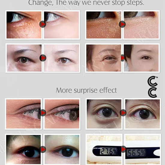 Anti Aging Peptides | Beauty Eyes Serum (10 vials per order) for Anti Puffiness Dark Circles Fine Lines Removal Moisturising Firming Eye Cream